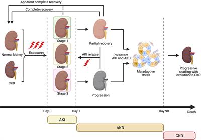 Stem Cell-Derived Extracellular Vesicles as Potential Therapeutic Approach for Acute Kidney Injury